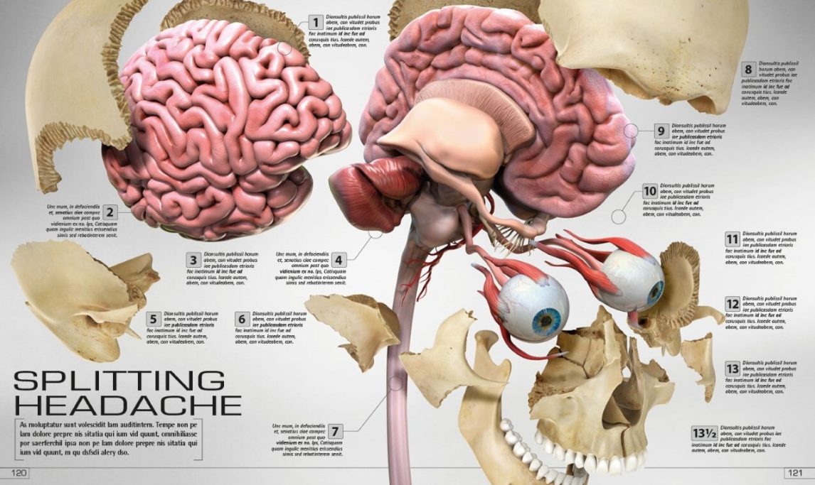 A splitting headache